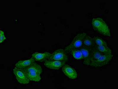Mitofilin Antibody in Immunocytochemistry (ICC/IF)