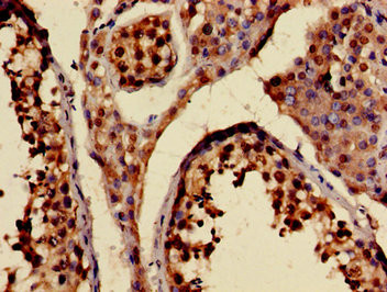 KIF20A Antibody in Immunohistochemistry (Paraffin) (IHC (P))