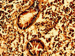 GSX1 Antibody in Immunohistochemistry (Paraffin) (IHC (P))