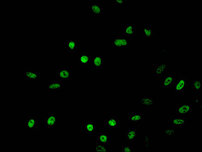 Acetyl-HIST1H2BB (Lys16) Antibody in Immunocytochemistry (ICC/IF)