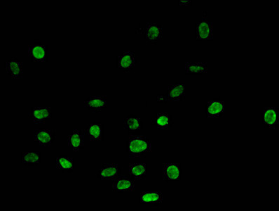 H4R3me1 Antibody in Immunocytochemistry (ICC/IF)