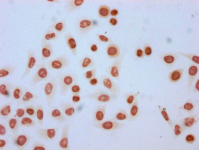 Formyl-HIST1H2AG (Lys95) Antibody in Immunocytochemistry (ICC/IF)