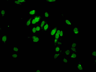 2-hydroxyisobutyryl-HIST1H2AG (Lys95) Antibody in Immunocytochemistry (ICC/IF)