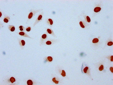Mono-methyl-HIST1H2AG (Lys9) Antibody in Immunocytochemistry (ICC/IF)