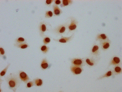 Mono-methyl-Histone 1F0 (Lys81) Antibody in Immunocytochemistry (ICC/IF)
