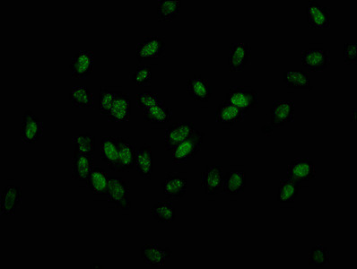 Phospho-Histone H1.3 (Thr179) Antibody in Immunocytochemistry (ICC/IF)