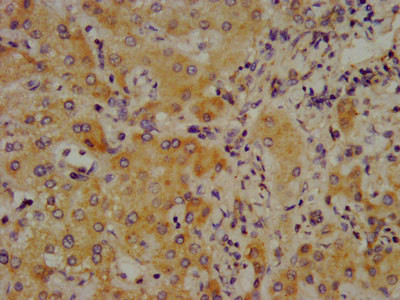 Complement C4 Antibody in Immunohistochemistry (Paraffin) (IHC (P))