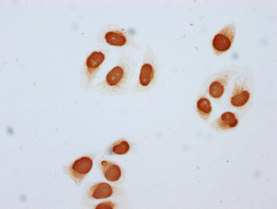 Acetyl-HIST1H2BC (Lys85) Antibody in Immunocytochemistry (ICC/IF)