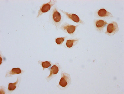 Acetyl-HIST1H2BC (Lys108) Antibody in Immunocytochemistry (ICC/IF)