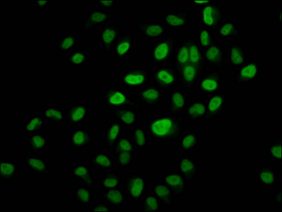 2-hydroxyisobutyryl-Histone H3 (Lys14) Antibody in Immunocytochemistry (ICC/IF)