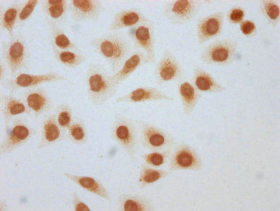 beta-hydroxybutyryl-Histone H3 (Lys56) Antibody in Immunocytochemistry (ICC/IF)