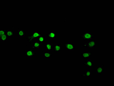 beta-hydroxybutyryl-HIST1H2BC (Lys120) Antibody in Immunocytochemistry (ICC/IF)