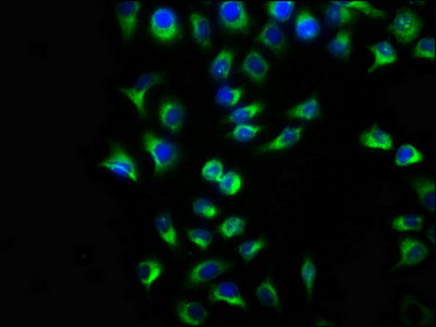 TMEM127 Antibody in Immunocytochemistry (ICC/IF)