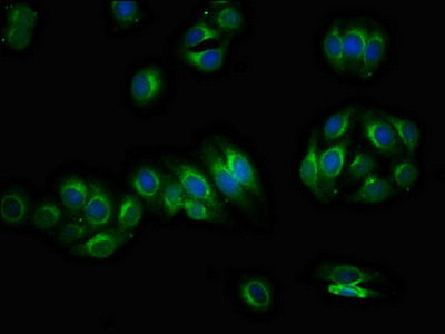 PIRT Antibody in Immunocytochemistry (ICC/IF)