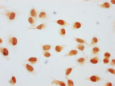 2-hydroxyisobutyryl-Histone H1.2 (Lys128) Antibody in Immunocytochemistry (ICC/IF)