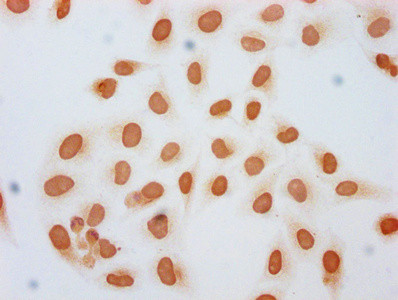 Formyl-Histone H1.2 (Lys45) Antibody in Immunocytochemistry (ICC/IF)