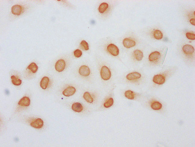 Acetyl-HIST1H2BC (Lys120) Antibody in Immunocytochemistry (ICC/IF)