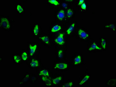 ARHGAP32 Antibody in Immunocytochemistry (ICC/IF)