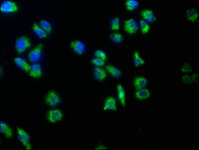 TRABD2B Antibody in Immunocytochemistry (ICC/IF)