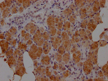 HTN3 Antibody in Immunohistochemistry (Paraffin) (IHC (P))