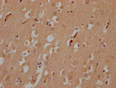 MYO15A Antibody in Immunohistochemistry (Paraffin) (IHC (P))