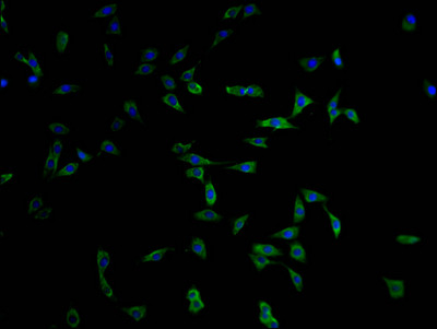 MYO15A Antibody in Immunocytochemistry (ICC/IF)