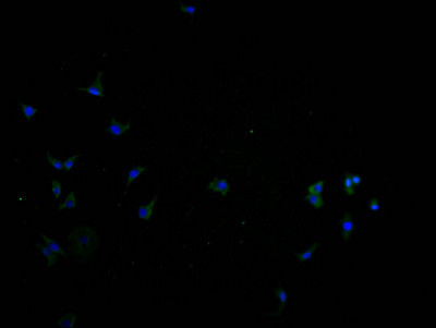 SLC22A10 Antibody in Immunocytochemistry (ICC/IF)