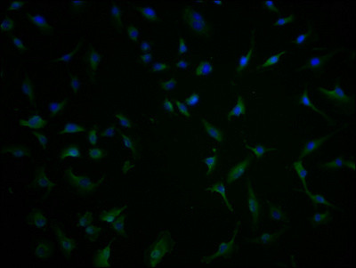 TBC1D3G Antibody in Immunocytochemistry (ICC/IF)