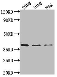 Salmonella typhi hupB Antibody in Western Blot (WB)