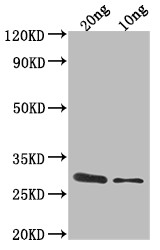 E. coli (strain K12) cas3 Antibody in Western Blot (WB)