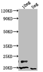 nlpD Antibody in Western Blot (WB)