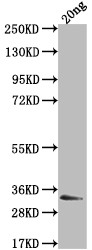 Epstein Barr Virus Nuclear Antigen 3 Antibody in Western Blot (WB)