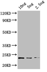 KNAT4 Antibody in Western Blot (WB)