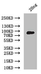 ERVK-5 Antibody in Western Blot (WB)