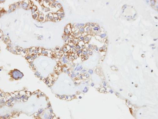 CD146 Antibody in Immunohistochemistry (Paraffin) (IHC (P))