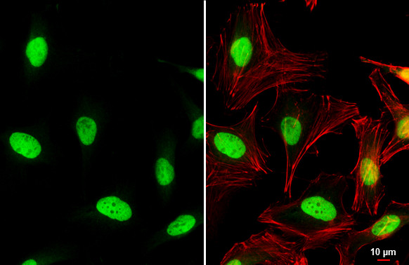 c-Jun Antibody in Immunocytochemistry (ICC/IF)