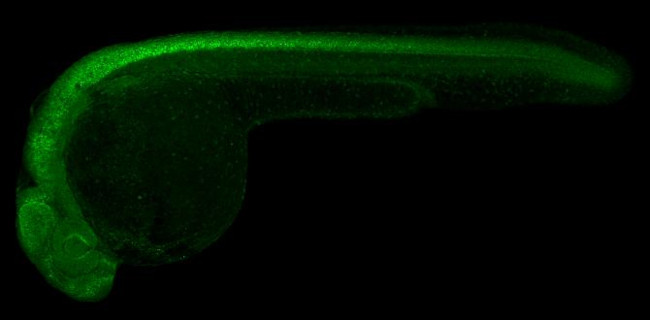 GFAP Antibody in Immunohistochemistry (IHC)