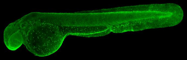 ATP6V1A Antibody in Immunohistochemistry (IHC)