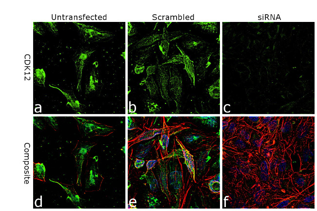 CDK12 Antibody in Immunocytochemistry (ICC/IF)
