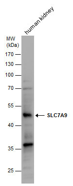 SLC7A9 Antibody in Western Blot (WB)