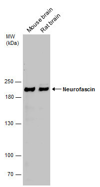 Neurofascin Antibody in Western Blot (WB)