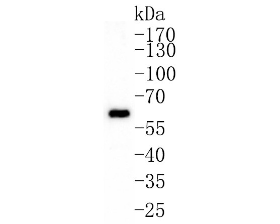 GRB7 Antibody in Western Blot (WB)