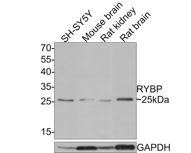 RYBP Antibody in Western Blot (WB)