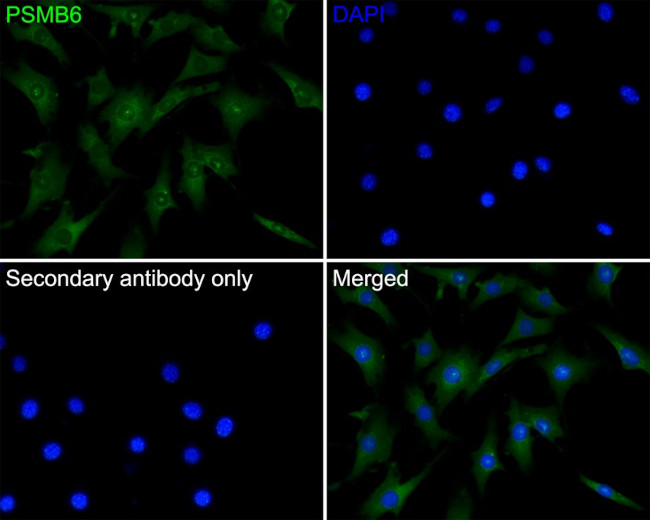 PSMB6 Antibody in Immunocytochemistry (ICC/IF)
