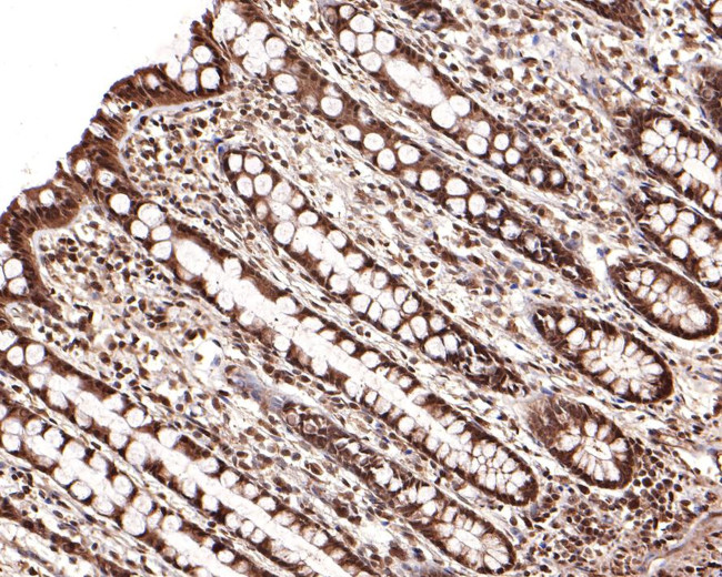 PSMD7 Antibody in Immunohistochemistry (Paraffin) (IHC (P))