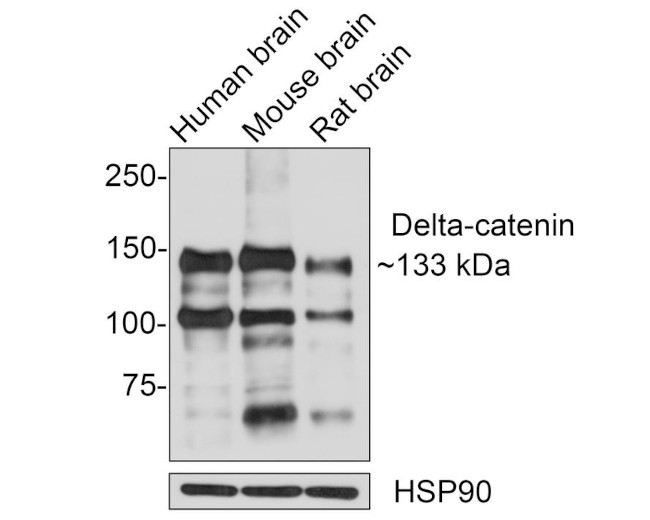 Catenin delta-2 Antibody in Western Blot (WB)