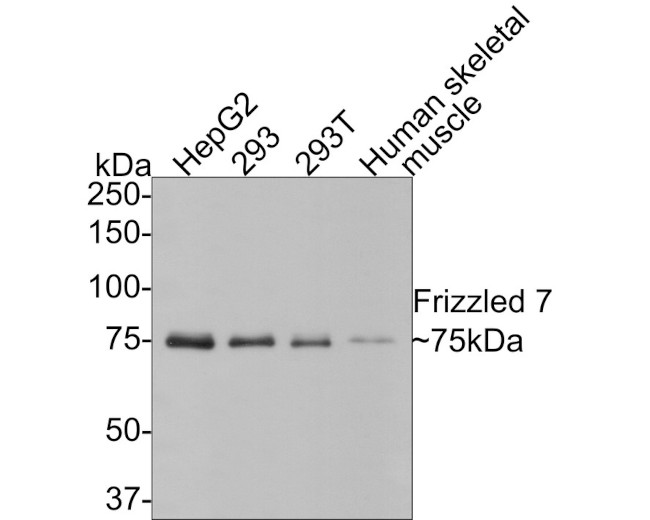 FZD7 Antibody in Western Blot (WB)