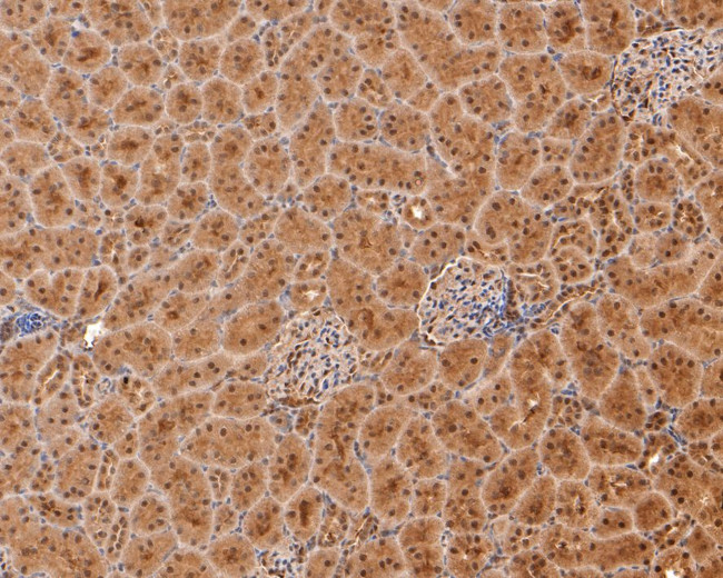 PSMA4 Antibody in Immunohistochemistry (Paraffin) (IHC (P))