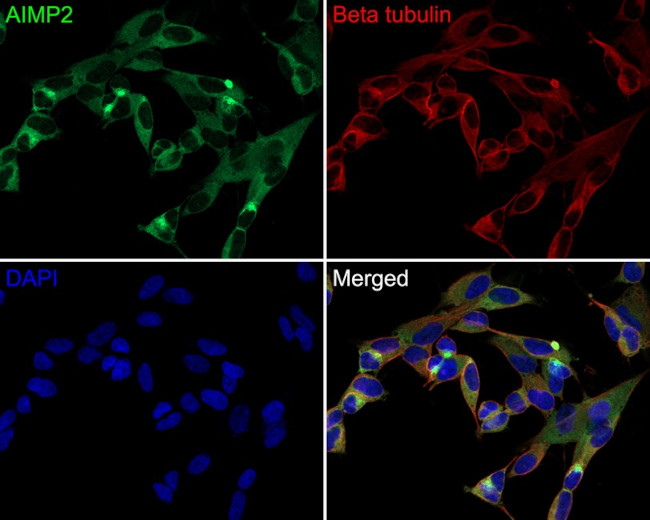 AIMP2 Antibody in Immunocytochemistry (ICC/IF)