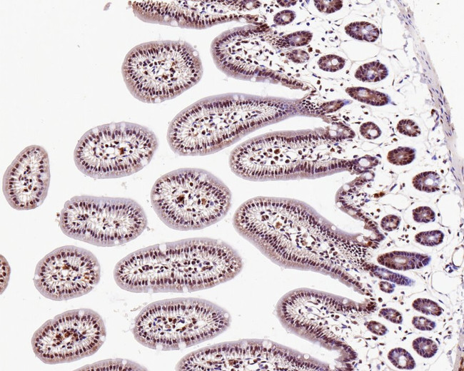 KDM6A Antibody in Immunohistochemistry (Paraffin) (IHC (P))